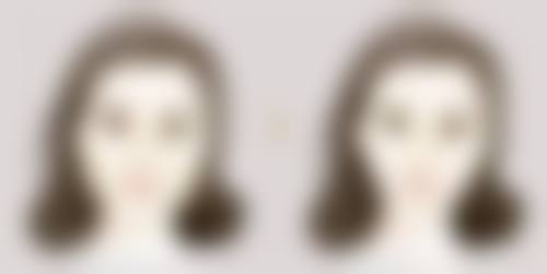 四、术后护理要点