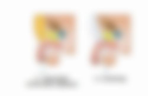 一、缝针疤痕形成的原因