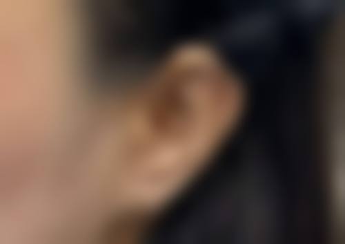 二、陆 军军 医 大学西 南医院(整形科)怎么样?