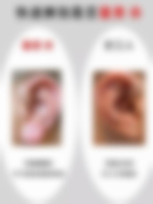 四、初雪整形外科特色项目