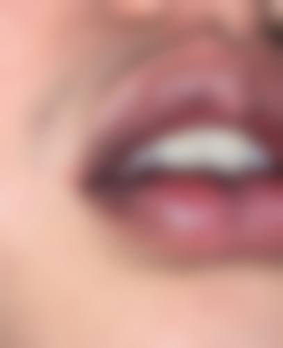 五、陆 军军 医 大学西 南医院(整形科)价格表