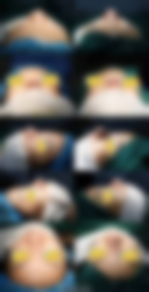 五、初雪整形外科价格表