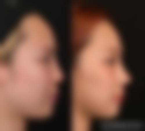 四、冯蔚枫收费价格表