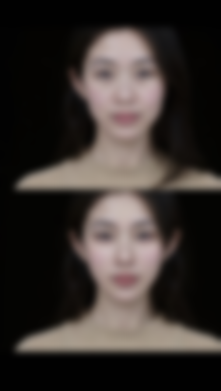 四、具体治疗方式