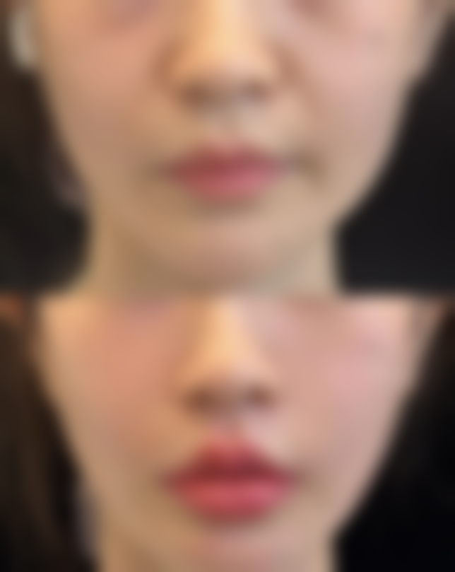 四、青岛智好美医疗美容门诊部特色项目