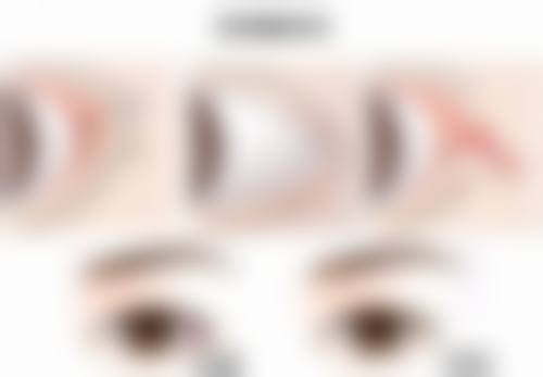 三、国产衡力瘦脸针与其他瘦脸针的对比