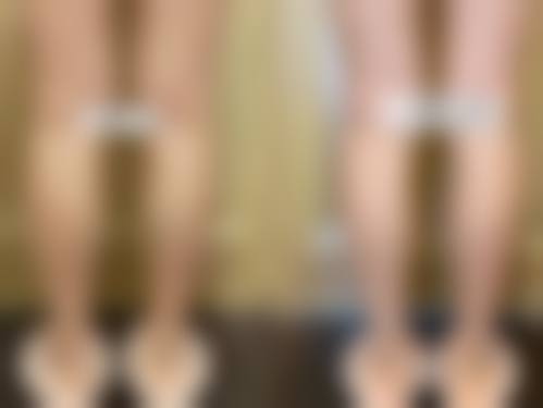 三、运城市皮肤病医院医学美容科诊疗项目有哪些?