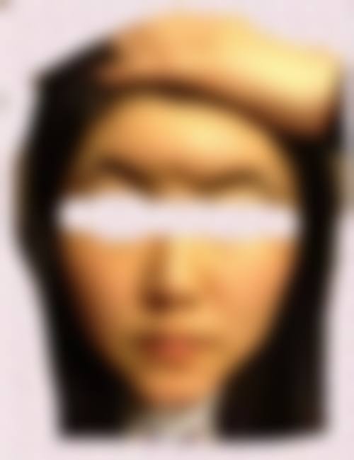 四、贵州医 科 大学附属乌当医院(烧伤整形科)特色项目