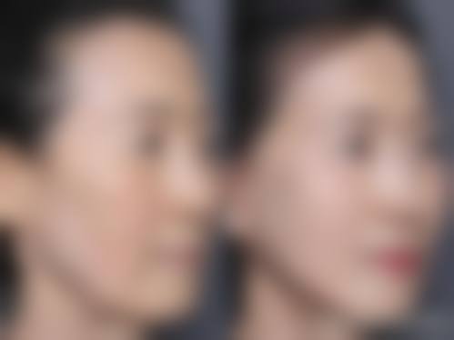 三、鹰潭爱玩美医疗美容诊疗项目有哪些?