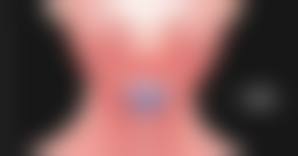 八、鹰潭爱玩美医疗美容真实的患者评价