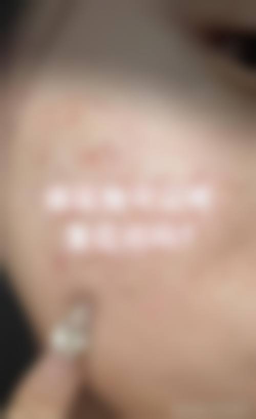 四、鹰潭爱玩美医疗美容特色项目