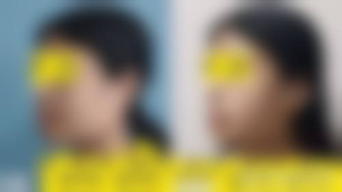 二、鹰潭爱玩美医疗美容怎么样?