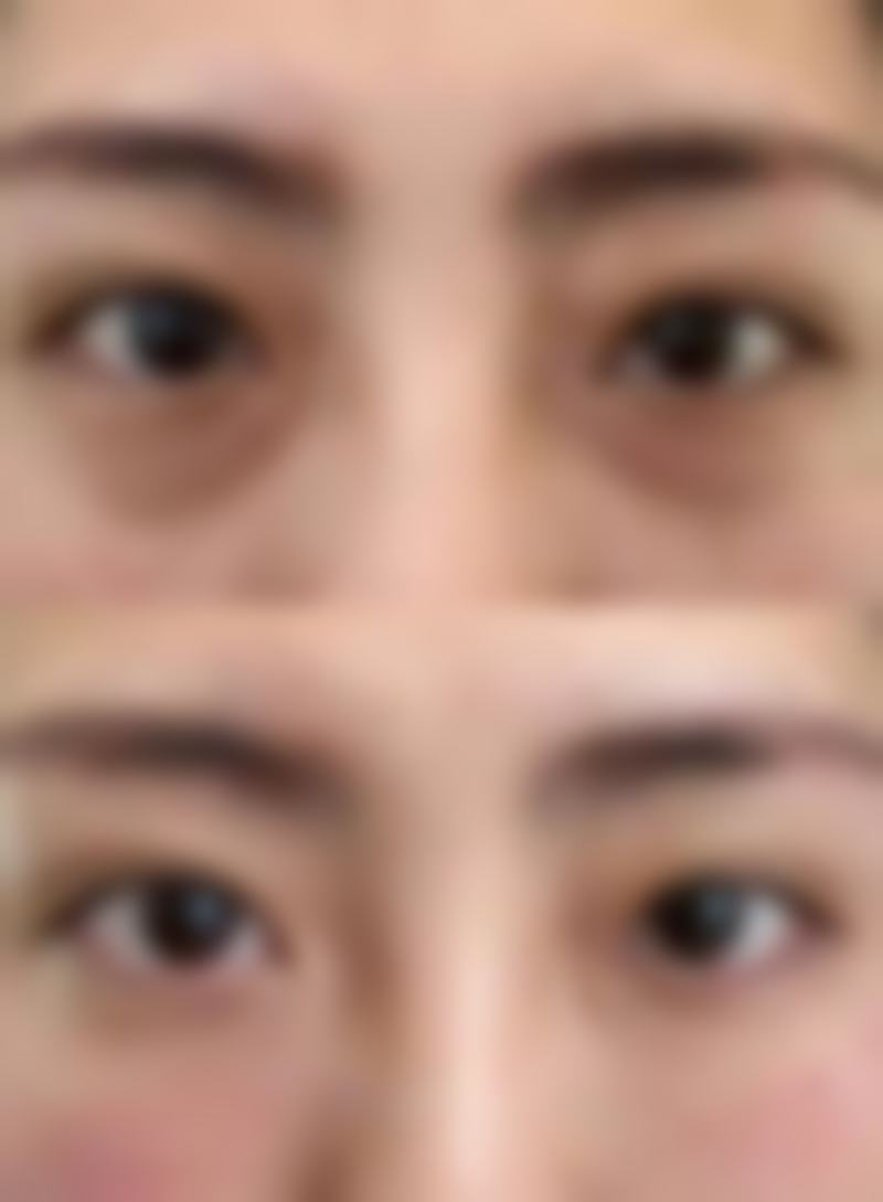 五、维西森茉整形医院价格表