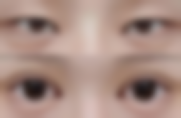 二、可以植发的情况