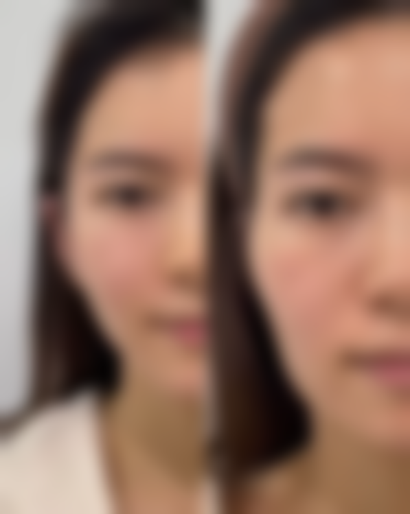 八、维西森茉整形医院真实的患者评价