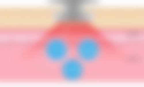 二、从成效图看两者差别