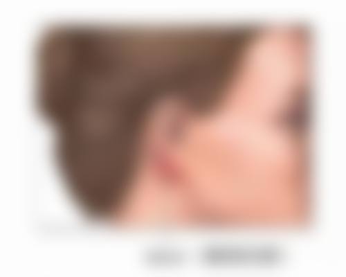 五、凹陷疤痕修复期间的注意事项