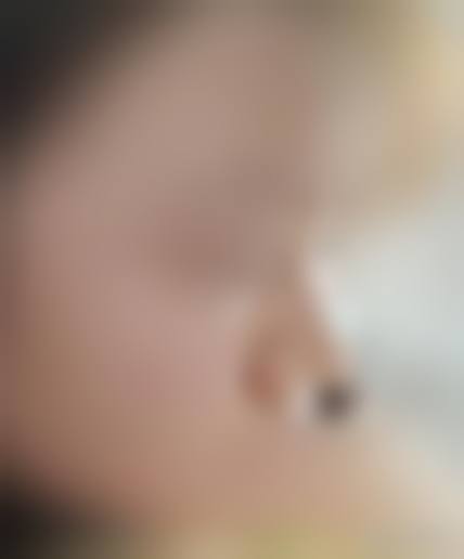 七、重庆医科大学附属第一医院(医疗美容科)预约方式