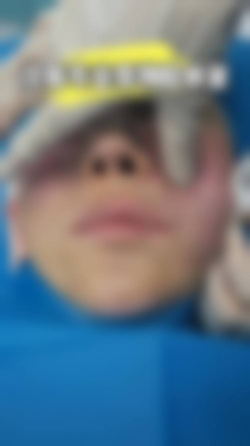 四、北京高兰德整形医院特色项目