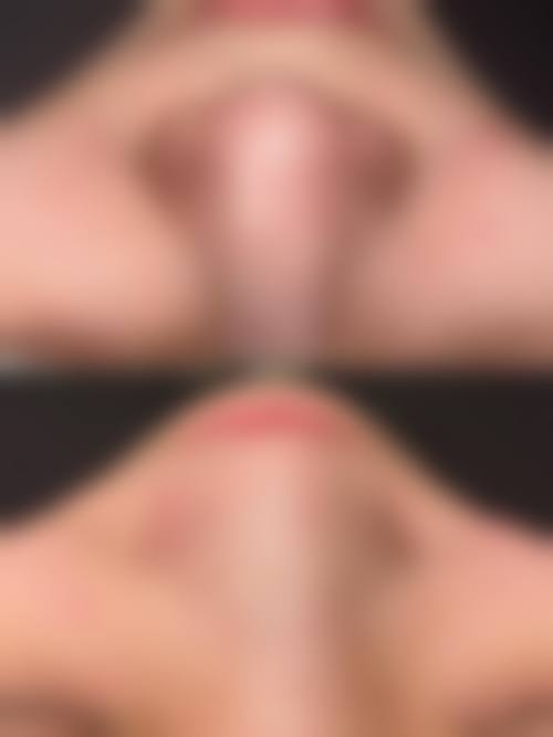 八、南昌青山湖雅美丽医疗美容门诊部真实的患者评价