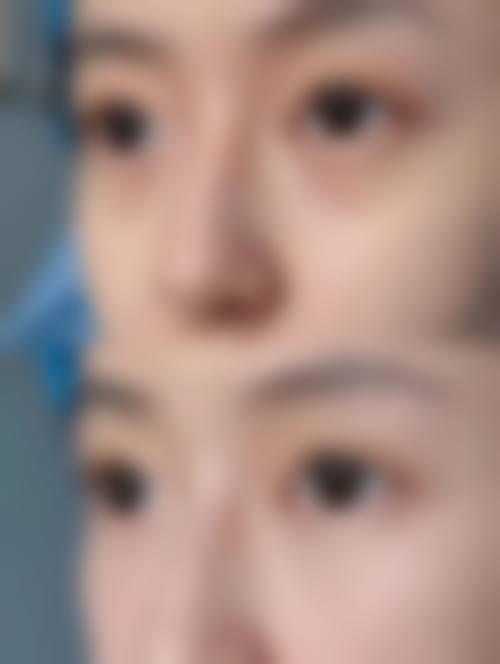 九、北京高兰德整形医院真实的患者评价