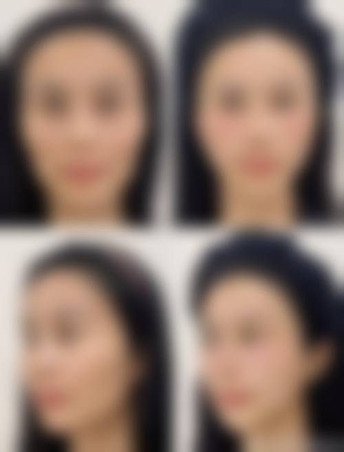 二、重庆医科大学附属第一医院(医疗美容科)怎么样?