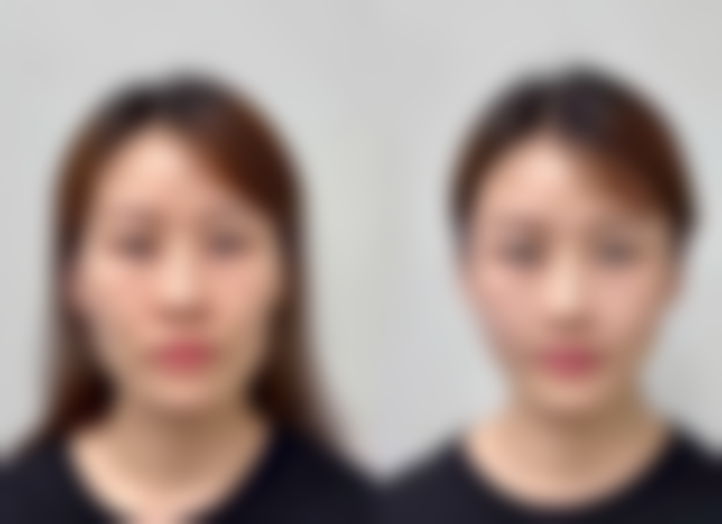 三、双眼皮吊顶与横梁的相互关系