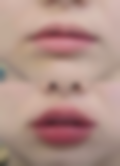 二、影响凹陷疤痕修复时间的因素