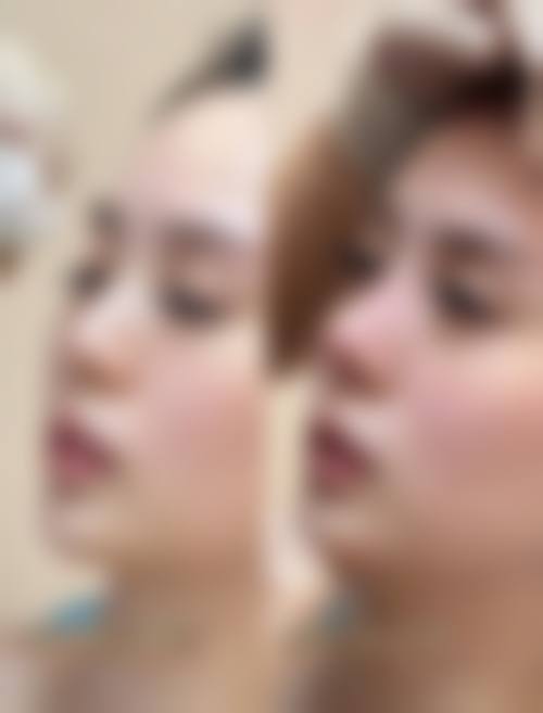 六、深圳锦瑄医疗美容诊所价格表