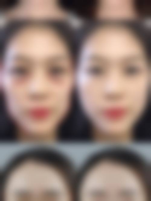 四、上海亚柏医疗美容诊所特色项目