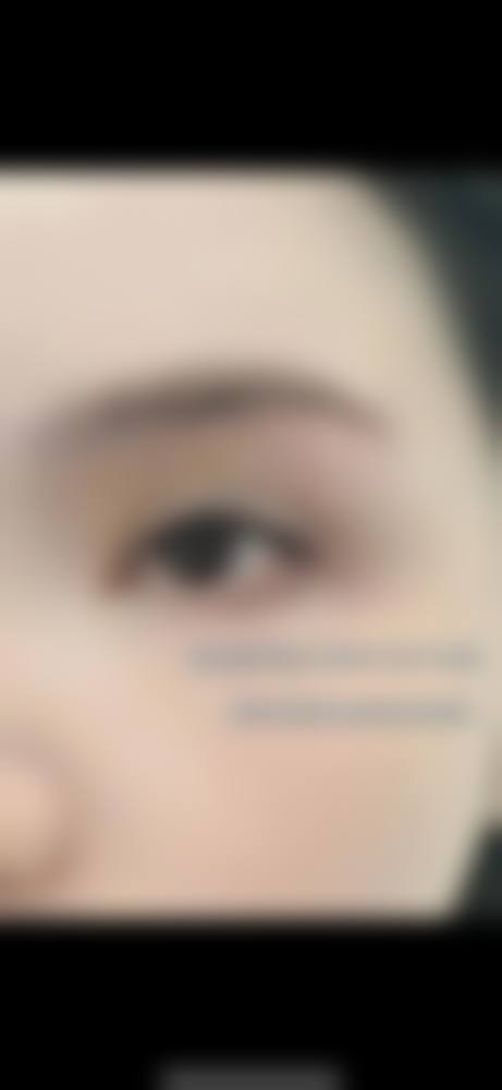 八、韩国LeeJiHam皮肤科 江南店真实的患者评价