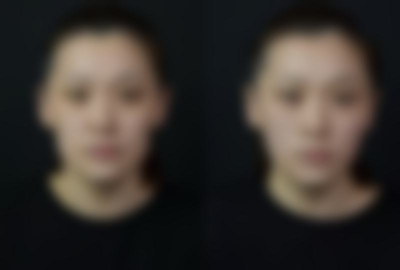 二、上海亚柏医疗美容诊所怎么样?