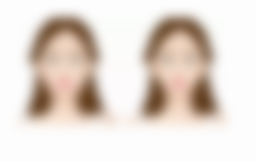 四、注射瘦脸针100u的注意事项