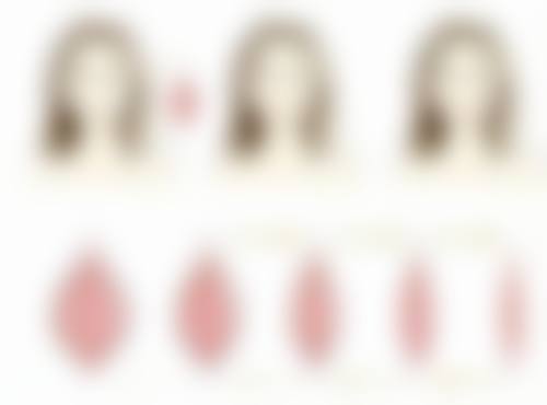 面部吸脂后会不会重新反弹？了解影响因素与维护方法，告别面部再胖烦恼！ 