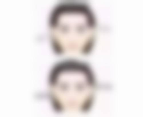 6d翘睫双眼皮永久吗？解析手术方式、个人体质等因素对持久度的影响 