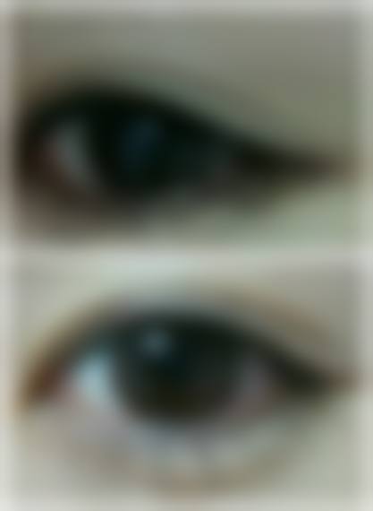 二、深圳玛利诺医疗美容门诊部怎么样？