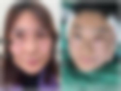 九、广州广美美姿整形医院真实的患者评价