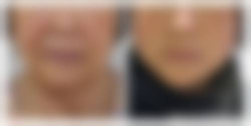 六、广州广美美姿整形医院价格表