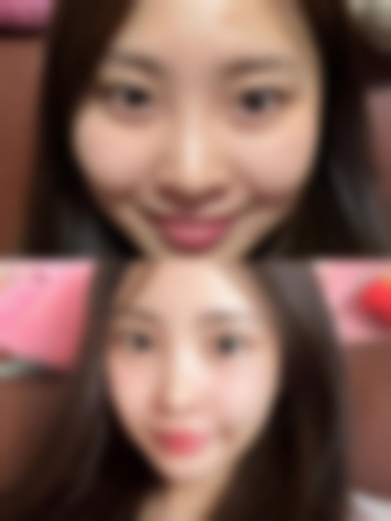 二、6d翘睫双眼皮能恒久吗