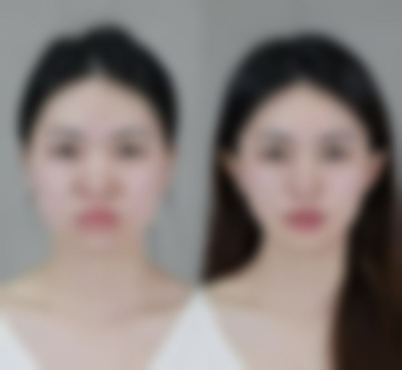 疤痕增生怎么治啊？药物、手术、物理疗法等多途径助你彻底治好疤痕增生 