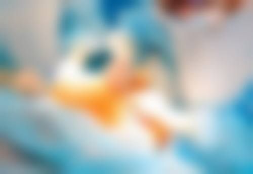 六、哪韩式双眼皮手术好之韩式双眼皮手术项目详情