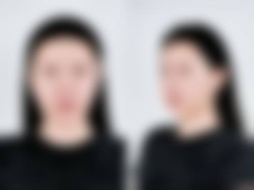 六、北京伊莎雅轩医疗美容医院价格表