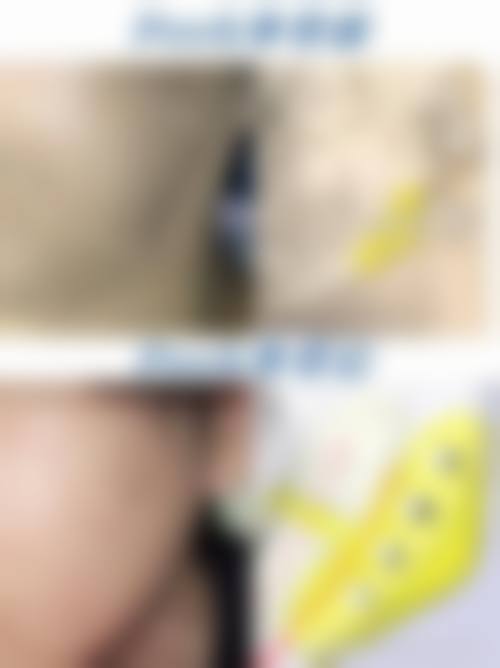 四、北京伊莎雅轩医疗美容医院特色项目