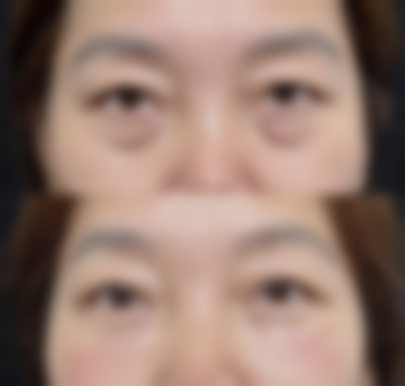 三、任璐璐技术优势