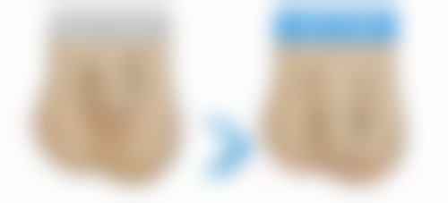 二、面部疤痕怎么去除小妙招之治疗方案选择