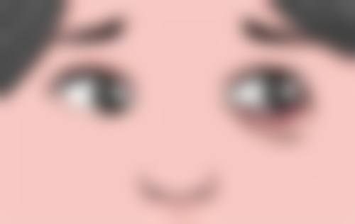 一、面部疤痕怎么去除小妙招之疤痕评估