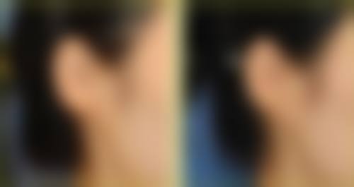 四、431整形外科特色项目