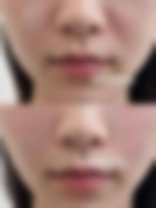 五、大连医 科 大学附属第二医院(整形美容病房)价格表