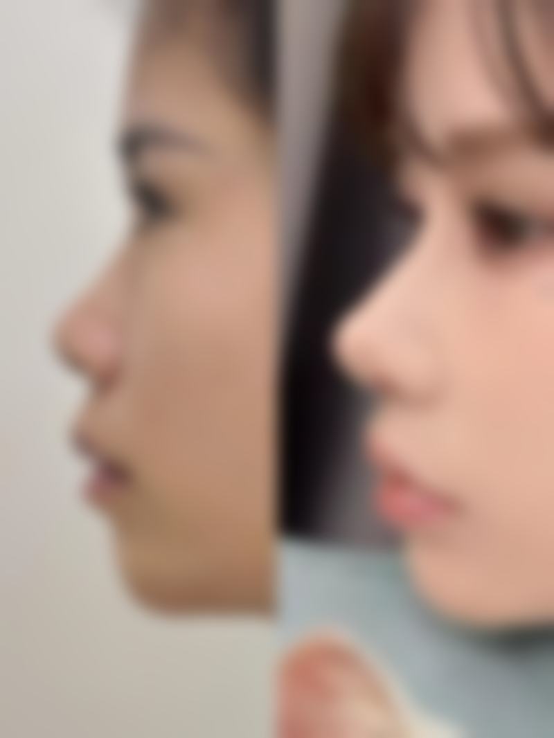 四、石家庄汉芳东购医疗美容诊所特色项目