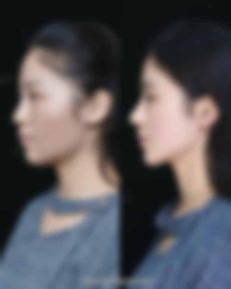 三、刘敏先医生擅长项目及技术优势